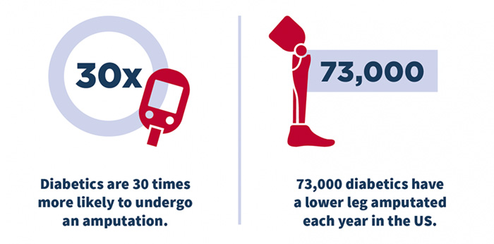 Diabetes data in America