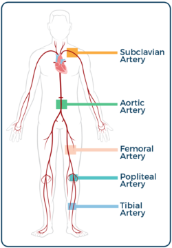 body's major artery